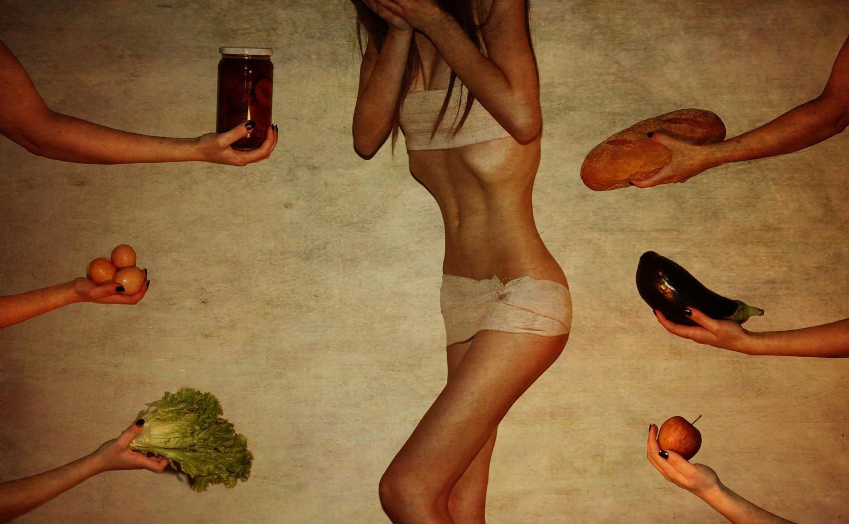Женский голод. Расстройство пищевого поведения анорексия булимия. Нервная анорексия и булимия.